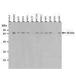 MSLN Antibody