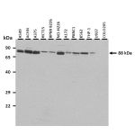 Western Blot