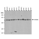 Western Blot