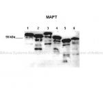 E.Coli: expressed human Tau-C, E.Coli: expressed human Tau-E, E.Coli: expressed human Tau-F, E.Coli: expressed human Tau-B, E.Coli: expressed human Fetal-Tau, E.Coli: expressed human Tau-D