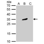 293T whole cell