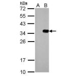 293T whole cell