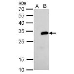 293T whole cell