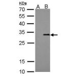 293T whole cell