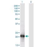 Transfected 293T cell line