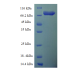 Protein SDS-PAGE