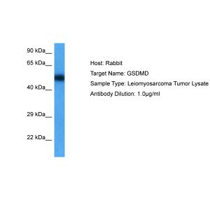 Human Leiomyosarcoma Tumor