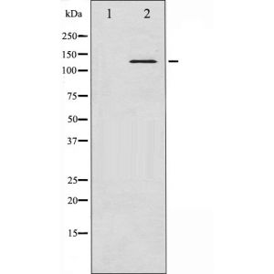 K562 whole cell lysates