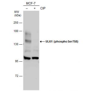 MCF-7 whole cell