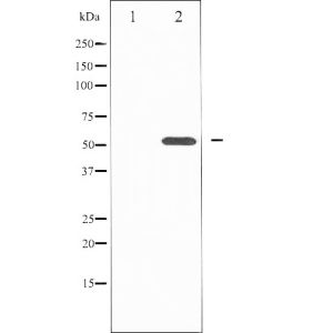 Mouse lung tissue lysates