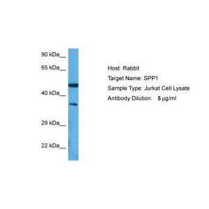 Human Jurkat Whole Cell