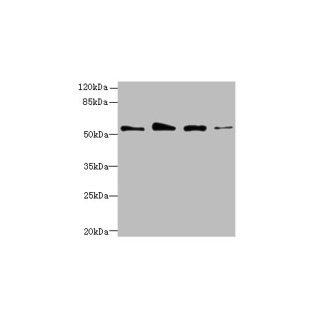 Jurkat whole cell lysate, Hela whole cell lysate, A431 whole cell lysate, U251 whole cell lysate