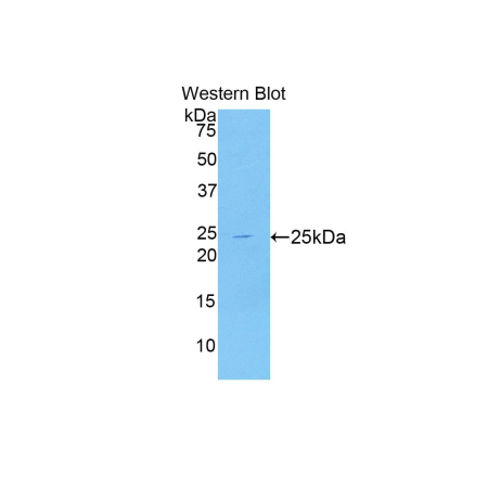 Puromycin Sensitive Aminopeptidase