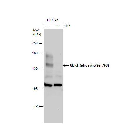 MCF-7 whole cell