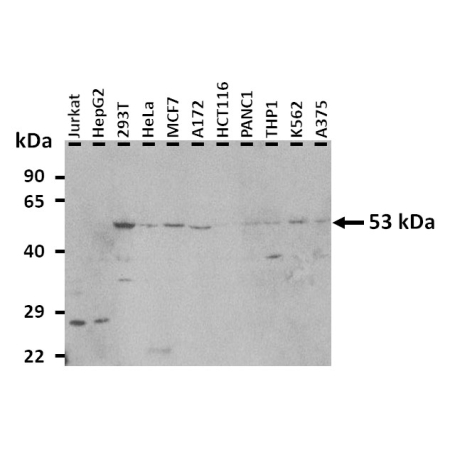 Western Blot